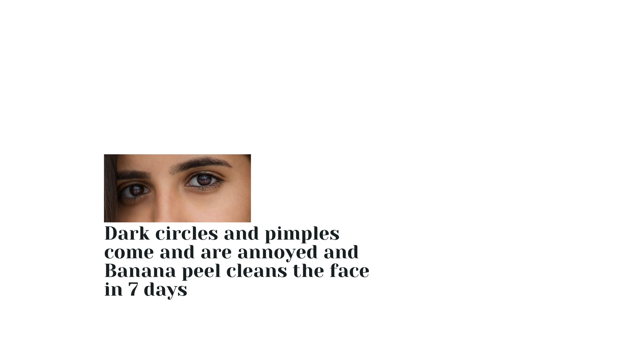 Dark circles and pimples come and are annoyed and Banana peel cleans the face in 7 days
